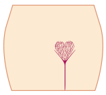 ブラジリアンワックスデザイン:かわいい「ハート」