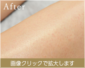 ムダ毛がなく、すべすべのきれいな脚